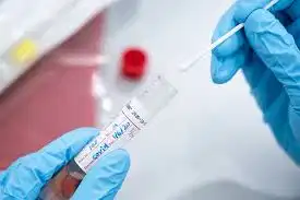 थाहामा कोरोना: साउनको सुरुकै दिन ७५ प्रतिशतमा संक्रमण पुष्टि थाहामा कोरोना: साउनको सुरुकै दिन ७५ प्रतिशतमा संक्रमण पुष्टि